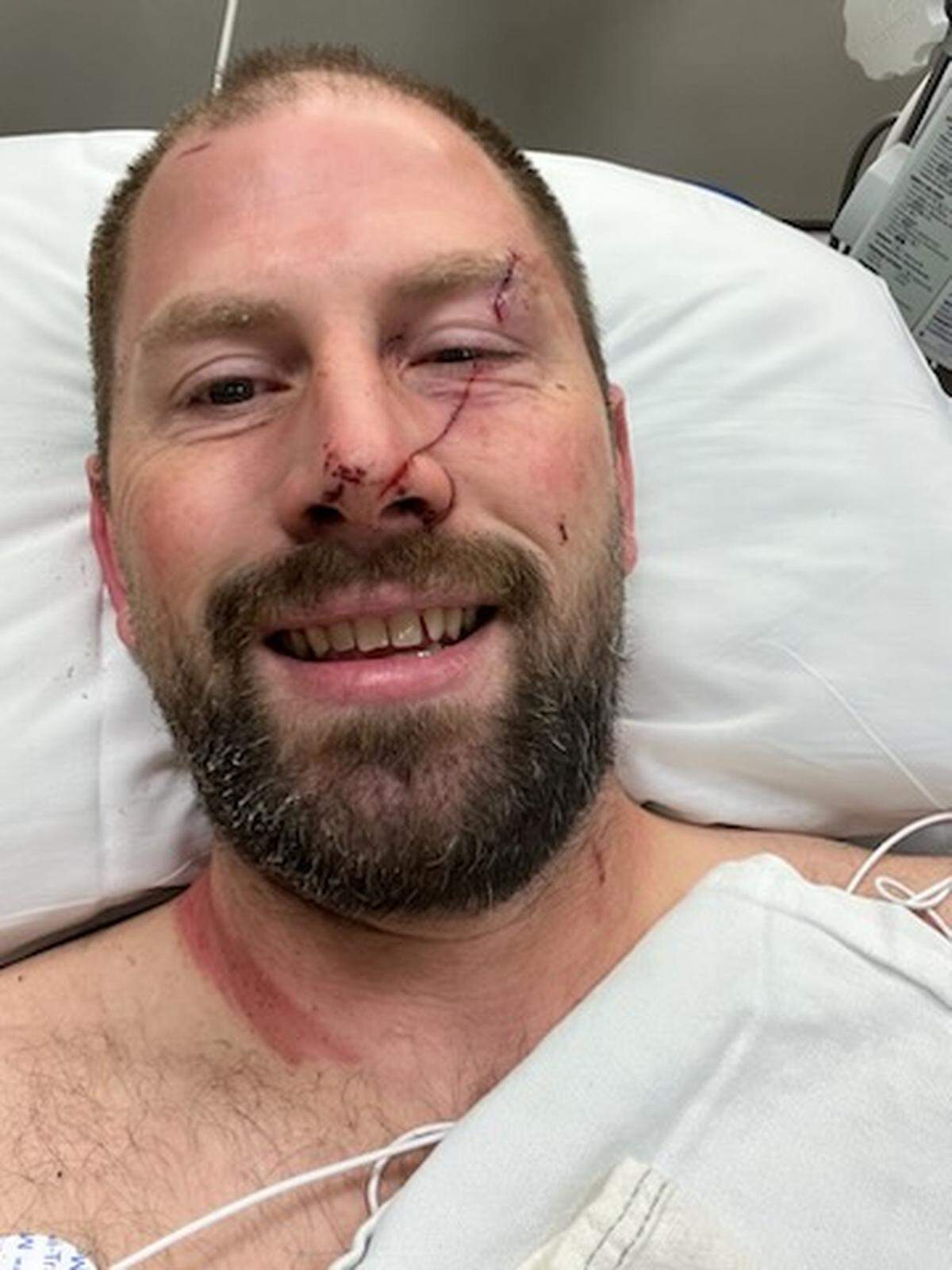 A selfie of Mike Beckett in the hospital with injuries he sustained in the float plane crash.