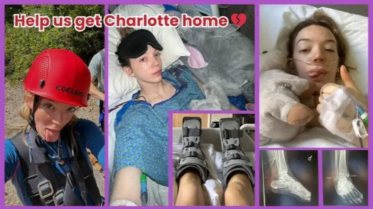These images on GoFundMe show Charlotte Hollins before and after her life-threatening accident near Gig Harbor.