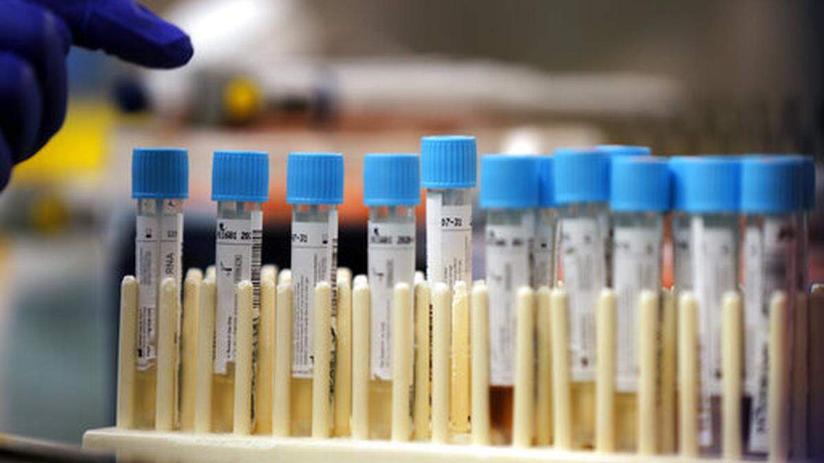 Vials with samples taken to test for the coronavirus. The Washington state Department of Health is shutting down the COVID-19 notification system in its WA Notify app on May 11.