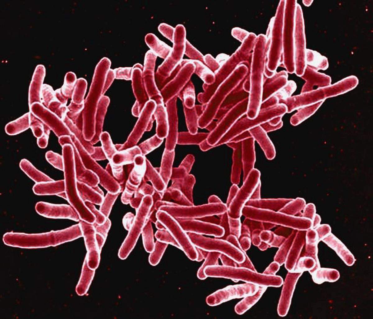 This digitally colorized scanning electron microscopic image depicts a grouping of red-colored, rod shaped, Mycobacterium tuberculosis bacteria, which cause tuberculosis (TB) in human beings.