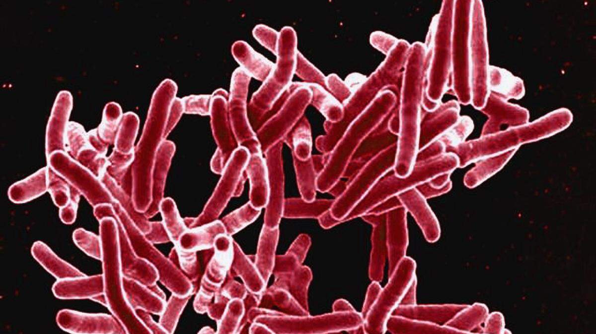 Court order still calls for arrest, detention of Tacoma woman avoiding TB treatment