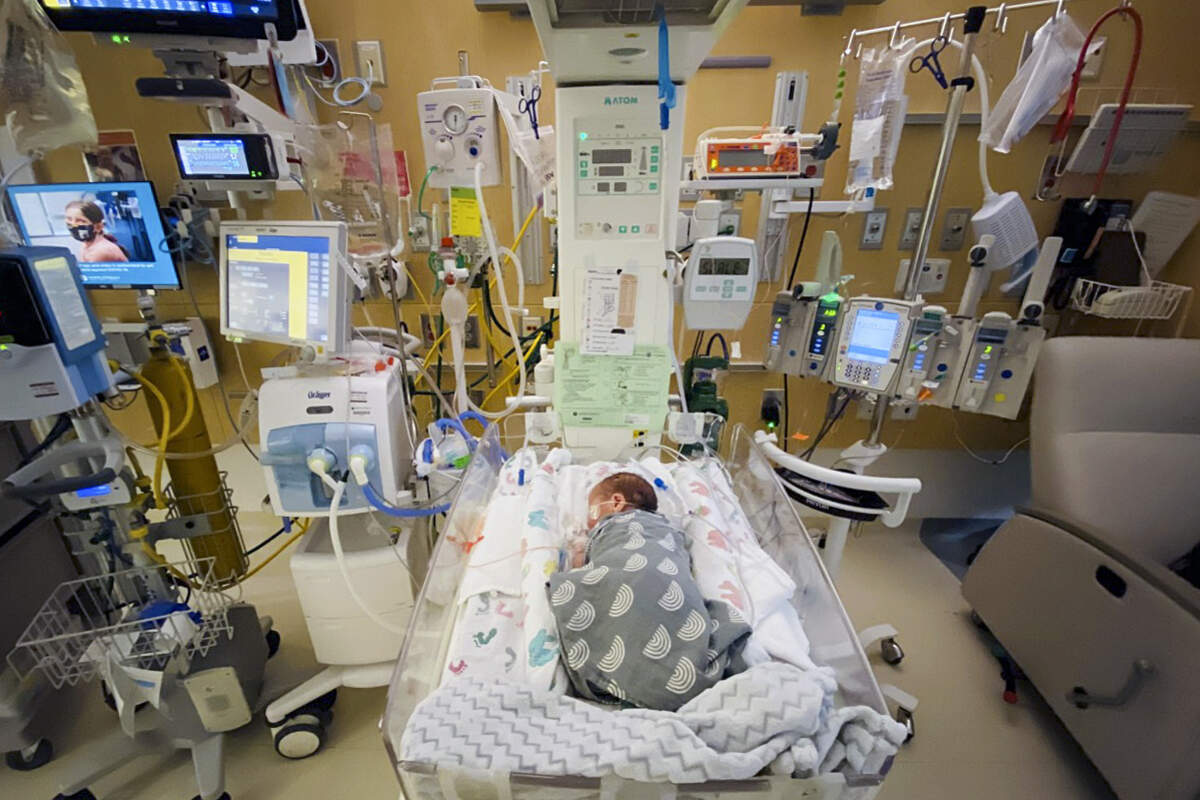 Newly born Oliver Setten lays in a natal intensive care unit room at Seattle Children’s Hospital.