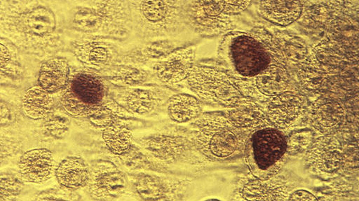 This 1975 microscope image made available by the the Centers for Disease Control and Prevention shows Chlamydia trachomatis bacteria magnified 200X. Washington saw more cases of chlamydia, gonorrhea and primary and secondary syphilis in 2016 compared to 2015.
