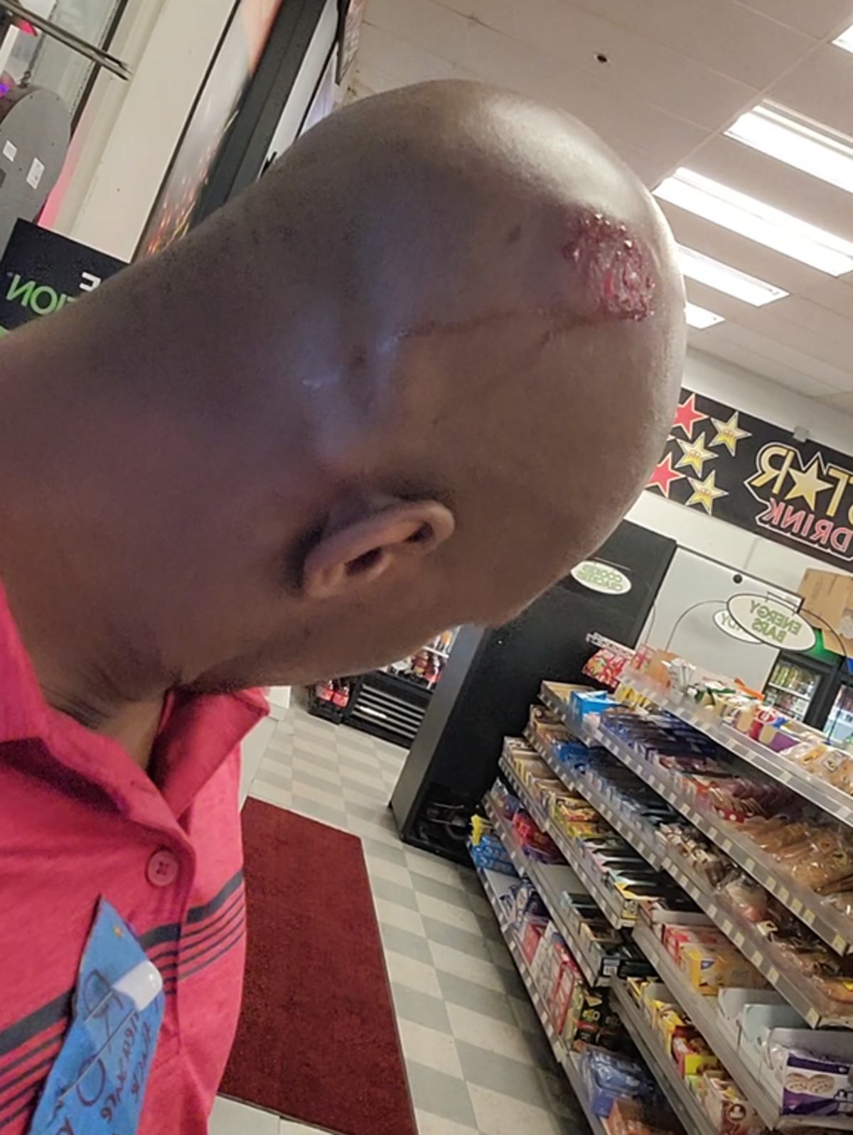 Job Irving, 30, shows his head wound after an altercation with gas station clerk, Kyle Braidwood, on Aug. 25, 2021, in Tacoma. Irving recorded himself waiting for police inside the store following the incident, less than an hour before he’d be fatally shot by Braidwood.