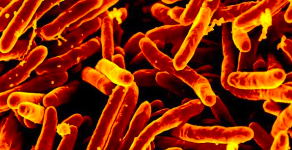 This image produced by the National Institute of Allergy and Infectious Diseases depicts a large group of orange-colored, rod shaped, Mycobacterium tuberculosis bacteria, which cause tuberculosis. An active TB case was recently reported with UC Davis’ campus community.