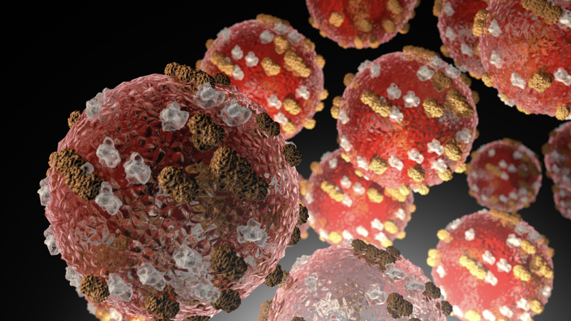 Measles cases confirmed north of Benton County. Children were unvaccinated