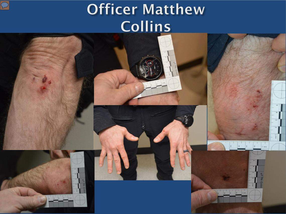 Images from the Washington State Patrol report on the Manuel Ellis case show photographs taken of Tacoma police officer Matthew CollinsÕ injuries on the night of EllisÕ death. Collins had scrapes on his elbows and knees. He later told investigators his right knee swelled up.