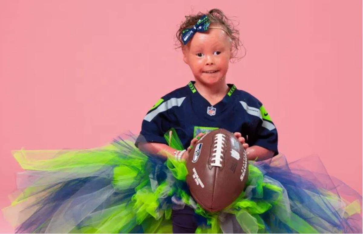 Harper Foy met Russell Wilson at Seattle Children’s when she was days old, getting life-saving treatment for a rare genetic condition called Harlequin Ichthyosis. Today she is an aspring model. Her mom credits Wilson for being a “calming and reassuring presence was so meaningful during such a difficult time.”