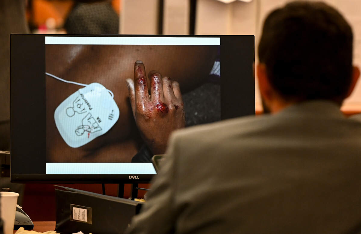 Defendant Christopher Burbank looks at evidence showing blood and lacerations on the hand of a deceased Manny Ellis during the trial of three Tacoma Police officers in the killing of Manny Ellis at Pierce County Superior Court, Tuesday, Oct. 24, 2023, in Tacoma, Wash.Tacoma Police Officers Christopher Burbank, Matthew Collins and Timothy Rankine stand trial for charges related to the March 2020 killing of Manny Ellis. (Brian Hayes / Pool Photo – The News Tribune)