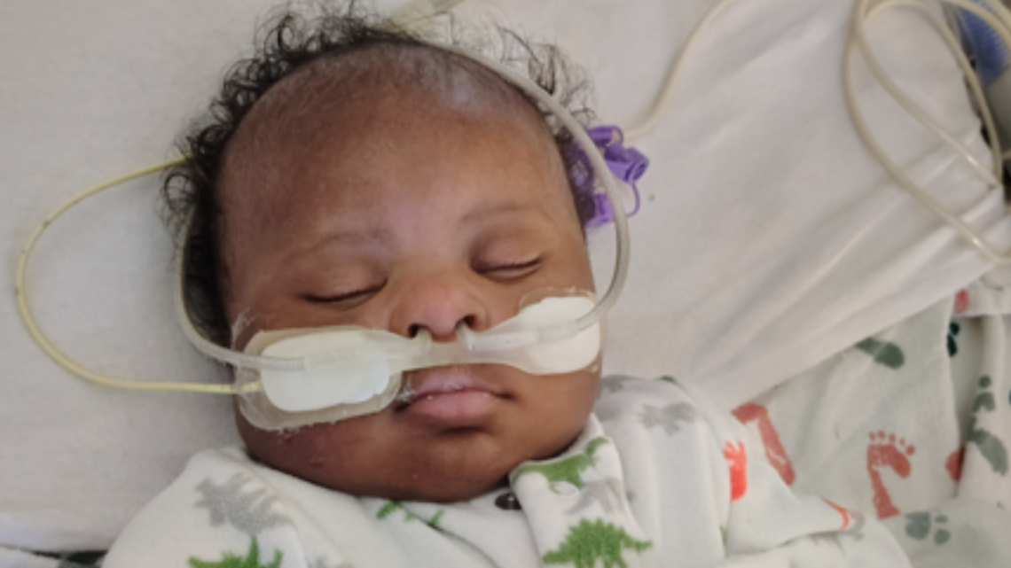 Tacoma infant saved by pioneering procedure: bloodless open-heart surgery