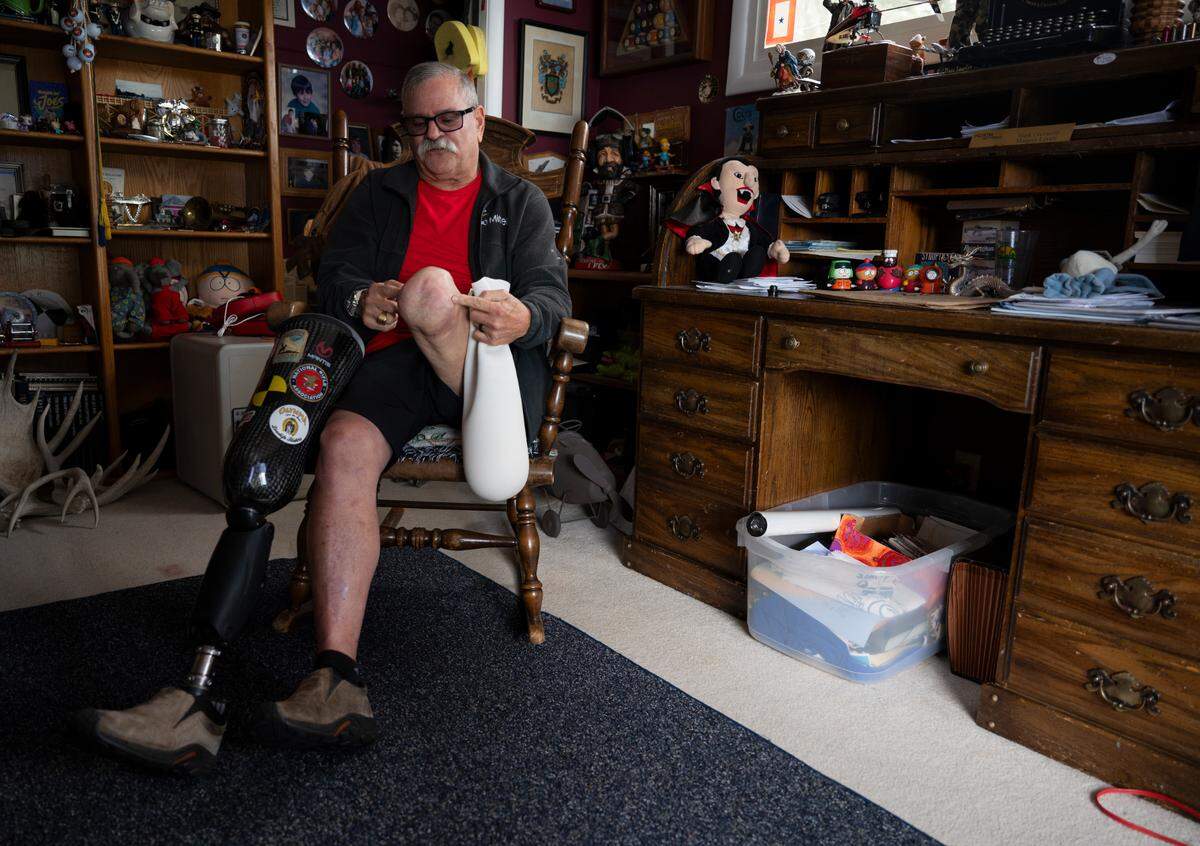 Mark Ceccarelli shows where his leg was amputated as a result of injuries from the crash. Photographed on Wednesday, Sept. 11, 2024, in Lakewood.