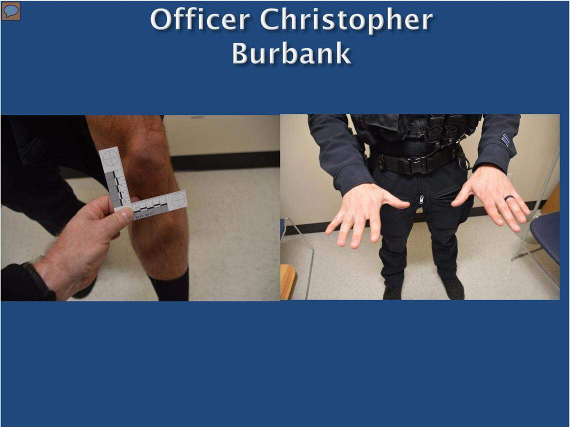 Images from the Washington State Patrol report on the Manuel Ellis case show photographs taken of Tacoma police officer Christopher BurbankÕs injuries on the night of EllisÕ death. Burbank had no visible injuries other than a minor abrasion on one knee, according to the report.