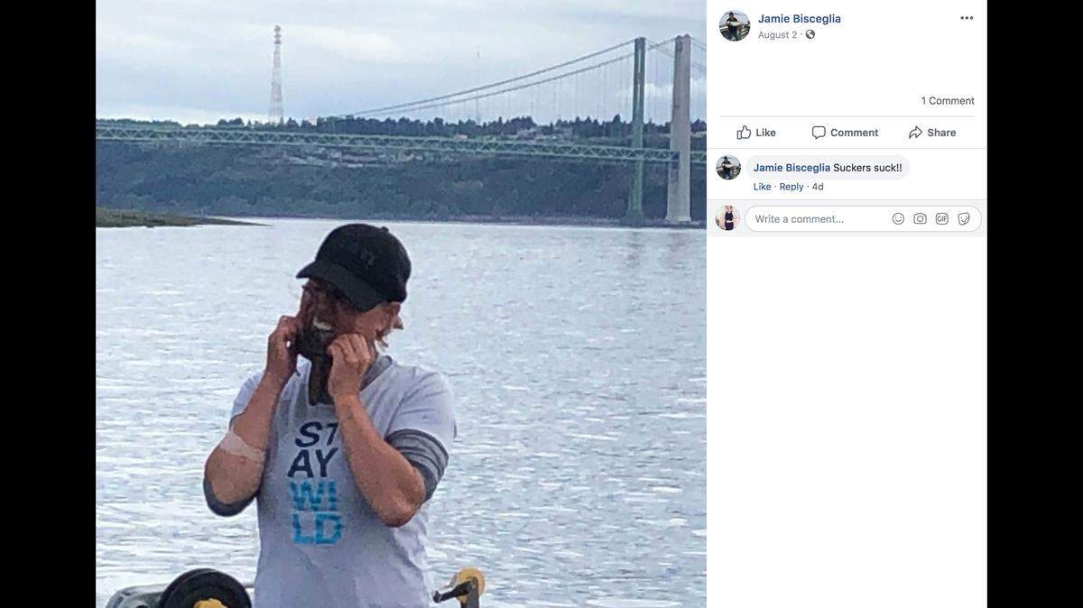 Jamie Bisceglia says she was bitten by an octopus and injected with venom while out on fishing in Washington.