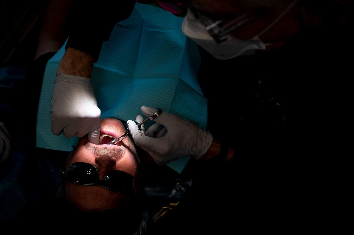Dr. Steve Urback, of Edgewood, works on a problematic molar in the mouth of Sjon Scarborough, of Sumner, during a free visit to the mobile dental clinic offered by the Medical Teams International at the Sumner Community Food Bank on Thursday, Aug. 25, 2022, in Sumner, Wash.
