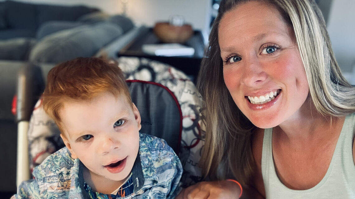 Millions of people have rare diseases, including my son. Here’s how Congress can help