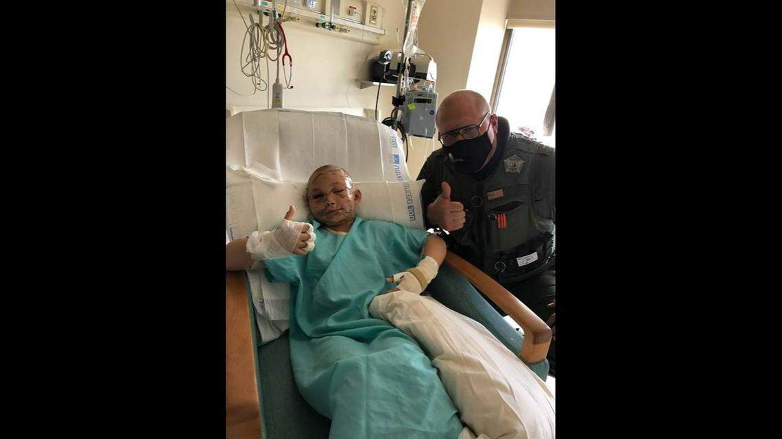 Lily A. Kryzhanivsky, 9, was attacked by a cougar on May 28, near Fruitland in Stevens County, Washington officials said. She’s in stable condition.