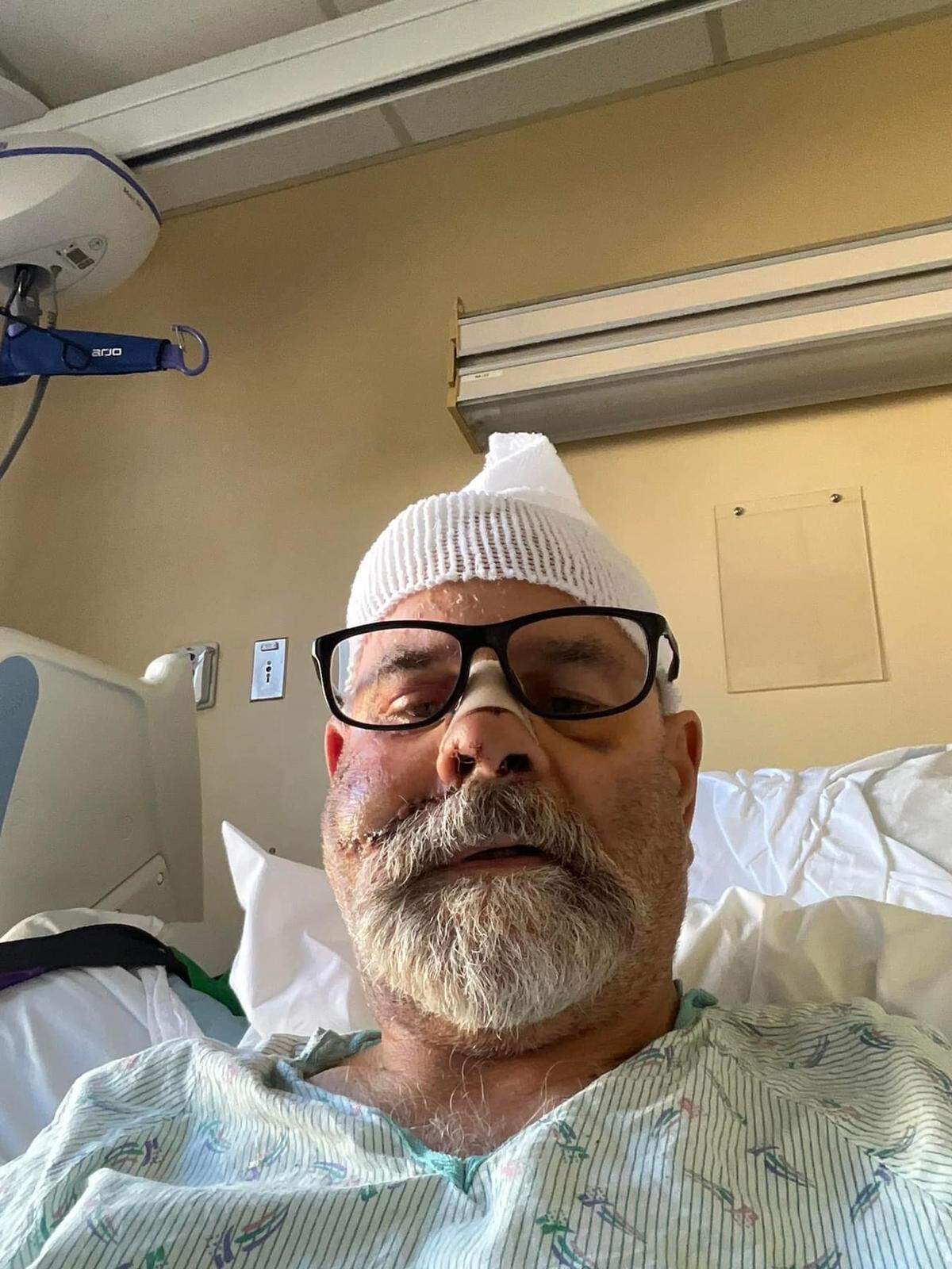 A selfie of Mark Ceccarelli in the hospital after his injuries from the float plane crash.
