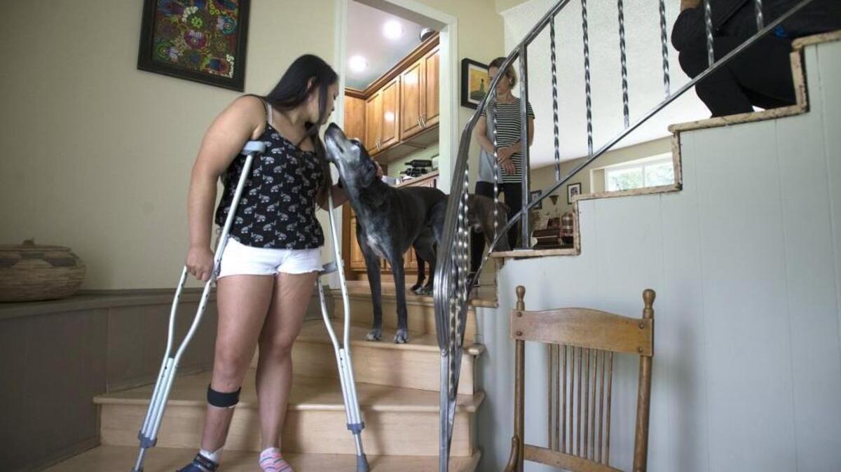 Joeli Reim at her family's home in Fircrest on June 27. In 2016, she had a rod inserted into her right femur, which, using magnets, gradually increased her leg in length.