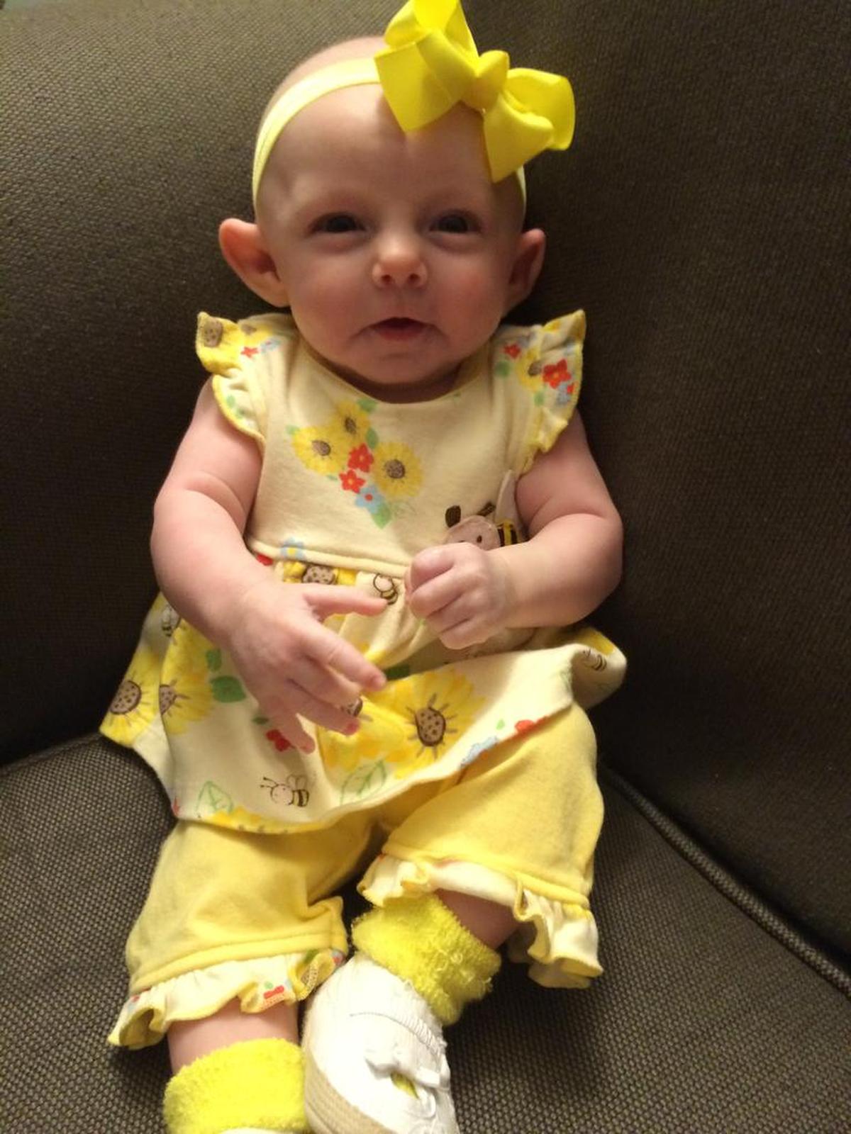 Cassidy was diagnosed with microcephaly at 6 months old, after her parents realized her head wasn’t growing. She died in her home in Puyallup in August.
