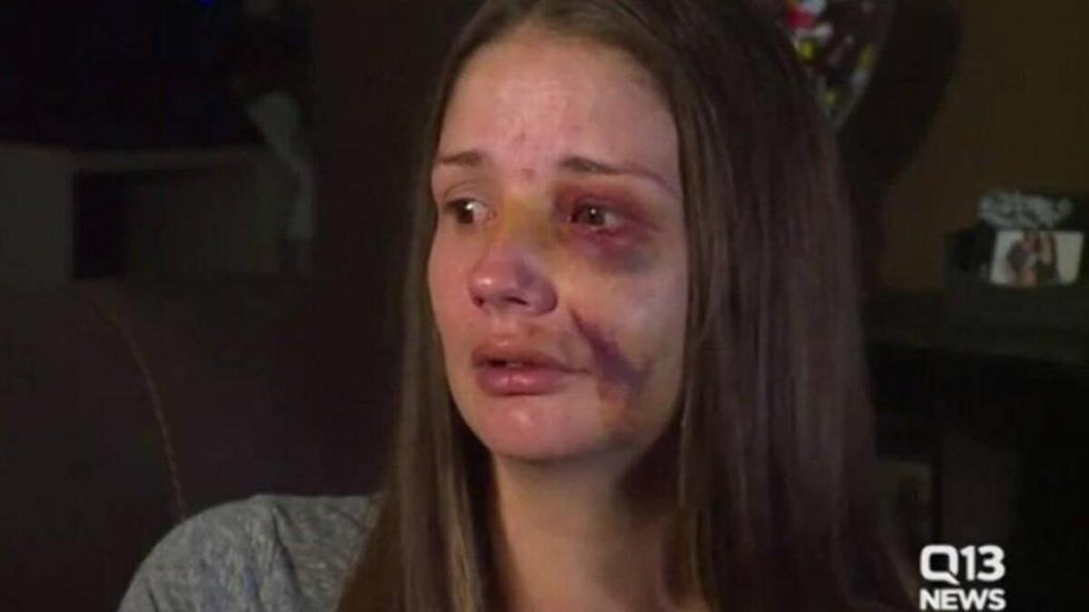 A Federal Way, Wash. woman tried warning others of a man fondling himself outside a grocery store, and then he attacked her, she says.