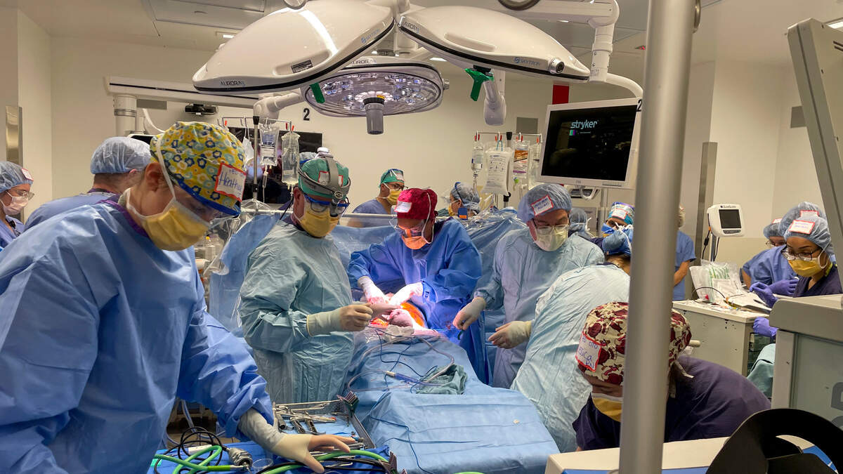 In this photo taken on Tuesday, Nov. 16, a team of 30 surgeons, anesthesiologists, nurses and others from University of Washington Medicine worked to give Oliver Setten air as he received life-sustaining blood and oxygen from his mother during a surgical procedure at University of Washington Medical Center in Seattle. The extraordinarily rare procedure, in which a baby’s birth is paused midway for sometimes up to two hours, gets performed just twice a year on average at the UWMC.