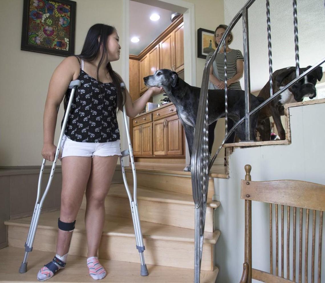 Joeli Reim was adopted from China by a Fircrest couple. Polio had left her with a leg shorter than the other. She underwent a revolutionary procedure that lengthened her leg by more than an inch.