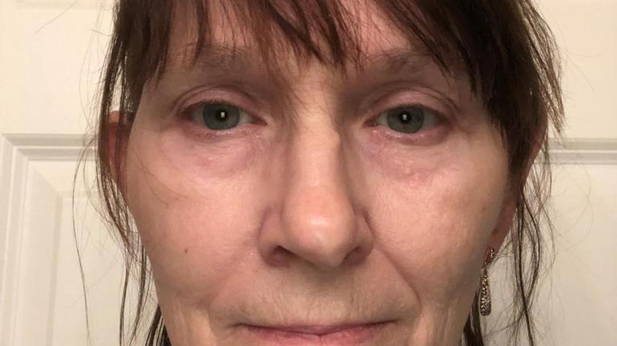 Pierce County resident Maria Higginbotham is a chronic pain patient. She lives in the Key Peninsula community of Wauna.