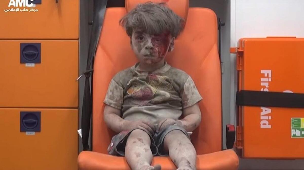 A 4-year-old boy named Omran sits in an ambulance after a house was destroyed in an Aug. 17 airstrike in Aleppo, Syria. Eight people, including five children, were said to have been killed in the attack. This photo went viral on social media and galvanized interest in the plight of the Syrian people, at least briefly.